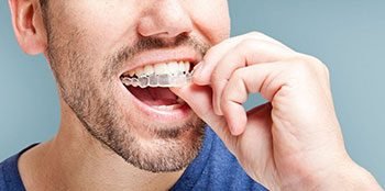 Aparelho Dental Invisível