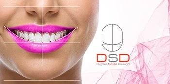 Planejamento Digital do Sorriso - DSD