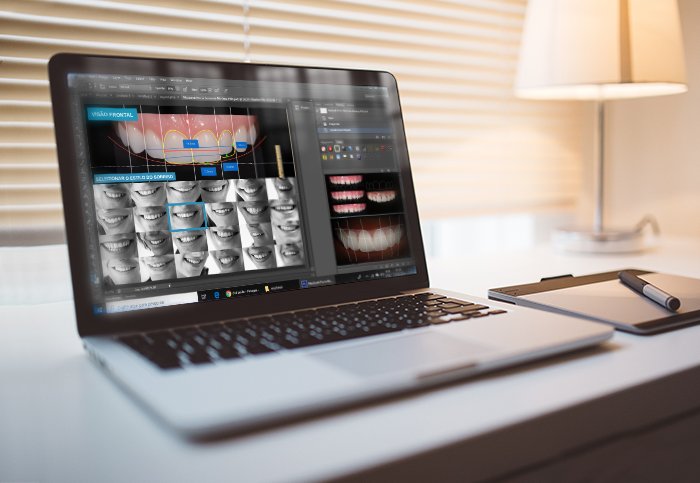 Picture of Planejamento Digital para seu Sorriso